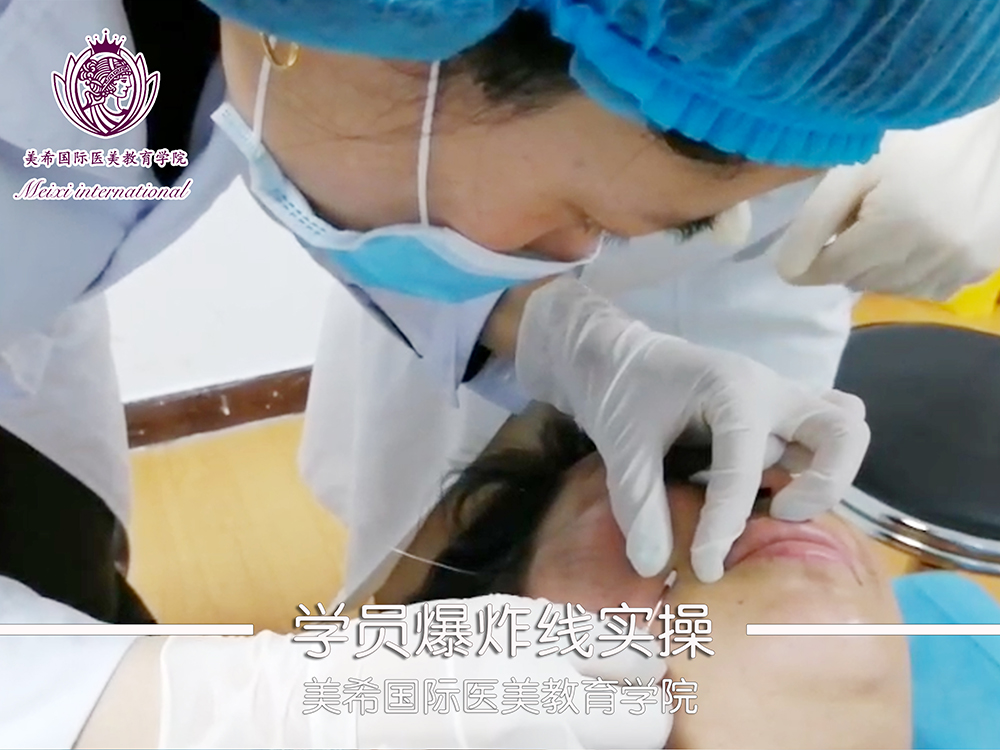 爆炸线实操