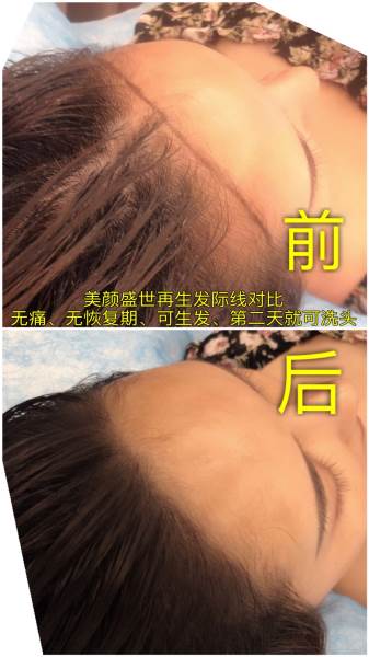 再生发效果展示一