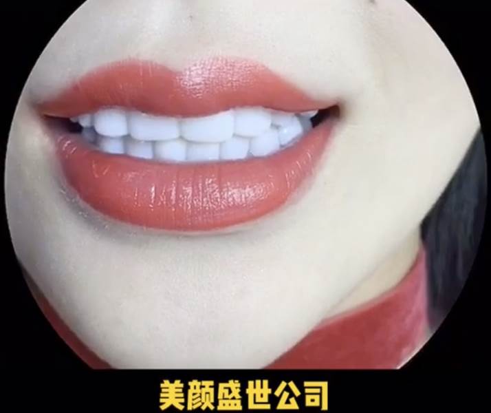 美牙效果对比一