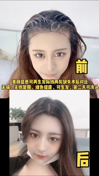 再生发效果对比二