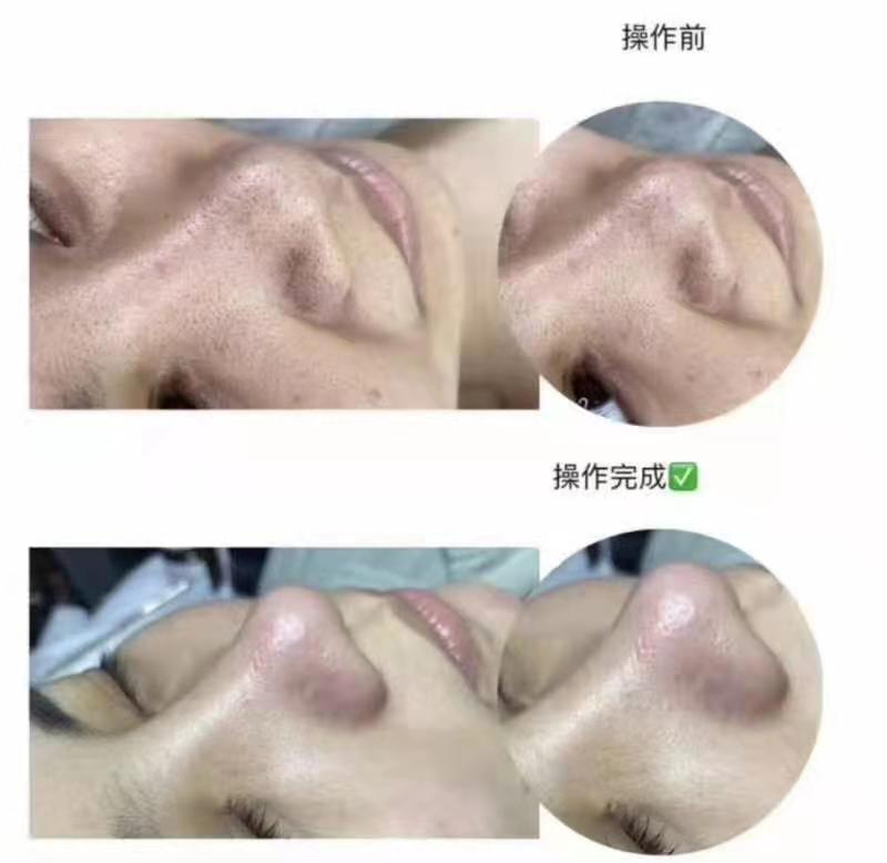 皮肤管理作品