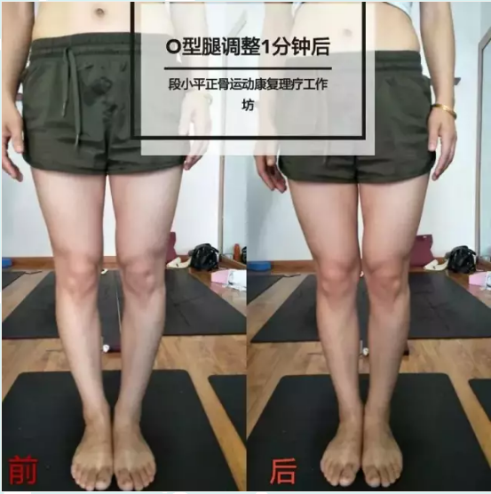 对比照