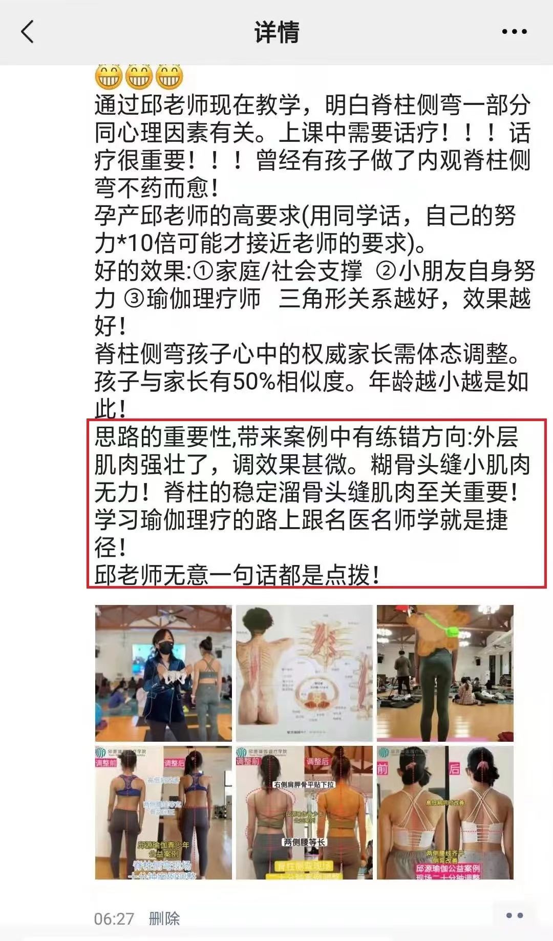 脊柱侧弯学员反馈